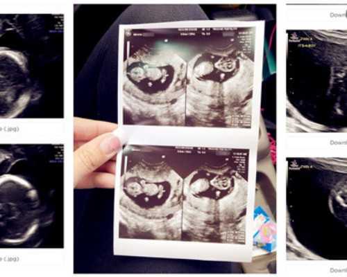 国内地下供卵机构名单,正式爆料!石家庄试管婴儿生个小孩花费?